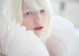 Snow Beauty: Incredible Albinos From Different Countries