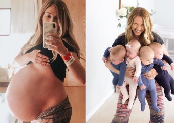 Quadruplet Mom’s Before and After Pregnancy Photos Are Incredible!