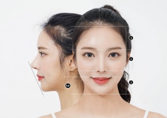 What is the V-Line Surgery: Everything You Need to Know About This Popular Celeb Procedure