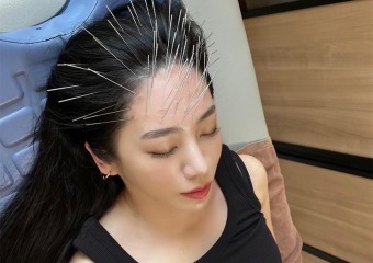 Acupuncture Craze Turns You into a Human Porcupine — But People Love It