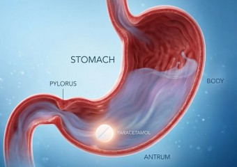In This Position, Paracetamol Works Up To Five Times Faster, Researchers Say