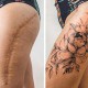 The Transformation of Scars Into Beautiful Tattoos