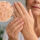 Make Age Spots A Thing Of The Past — People Are Ditching Expensive Creams For This Simple Dark Spot Trick